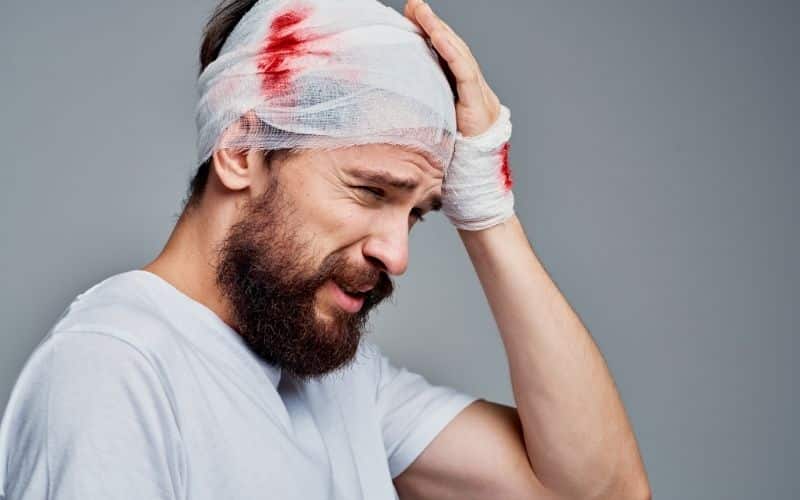 Concussions