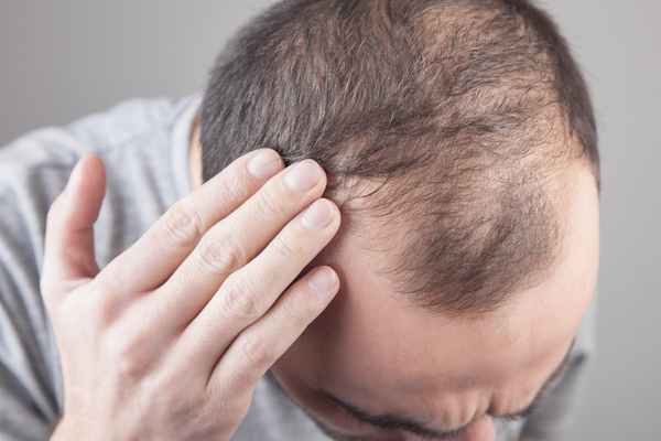 hair loss